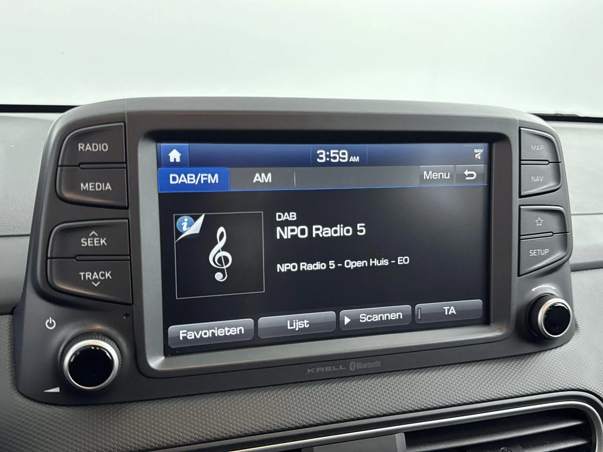 Hyundai Kona 1.0 T-GDI Comfort 120PK