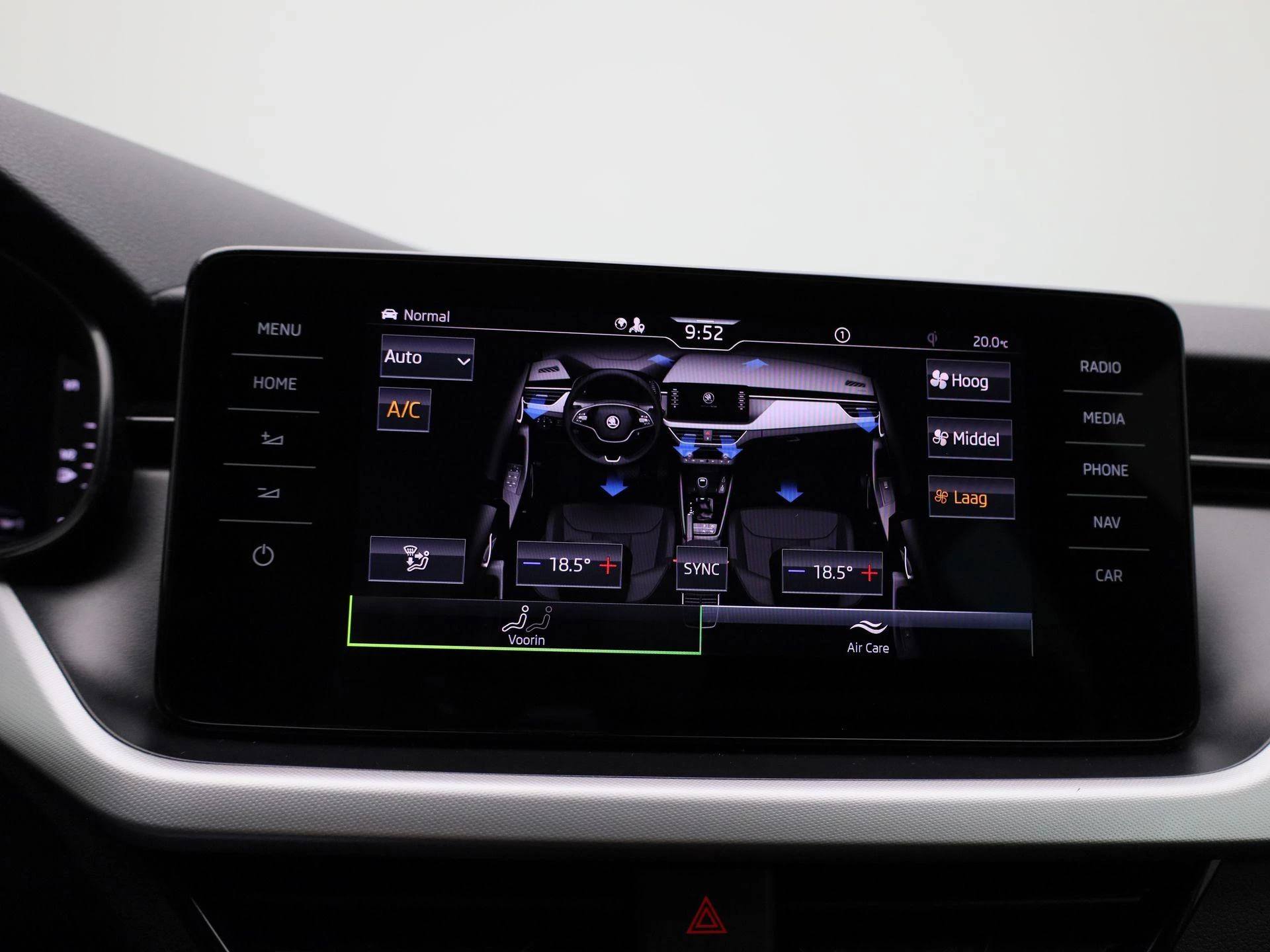 Škoda Scala 1.0 TSI Sport Business