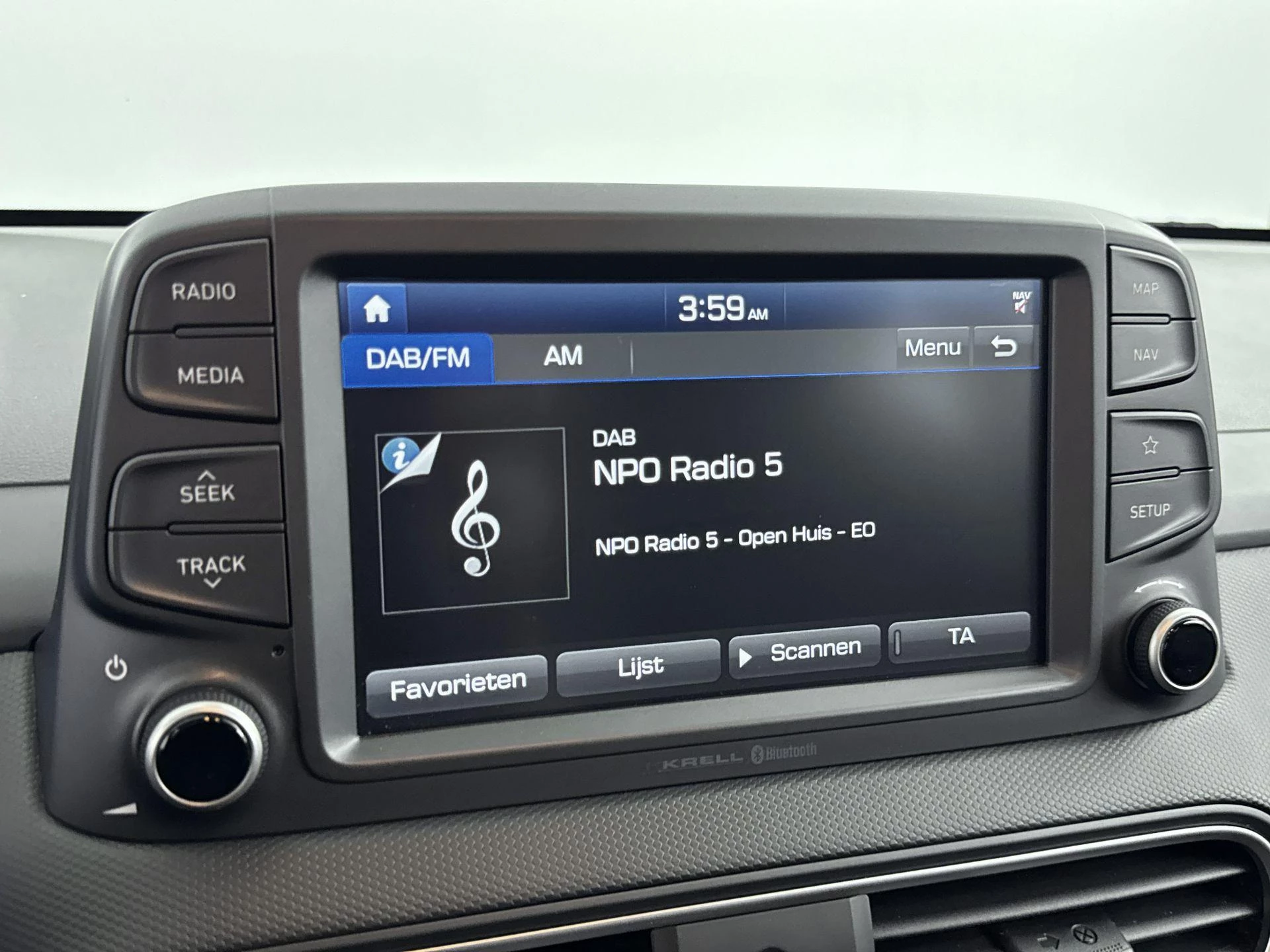 Hyundai Kona 1.0 T-GDI Comfort 120PK